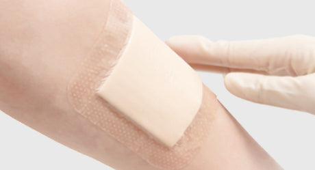 Post-Surgical Wound Formation and Care